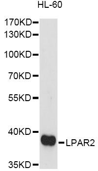 Western blot - LPAR2 Polyclonal Antibody 