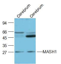 Fig1: Sample:; Cerebrum (Mouse) Lysate at 40 ug; Cerebrum (Rat) Lysate at 40 ug; Primary: Anti-MASH1 at 1/2000 dilution; Secondary: IRDye800CW Goat Anti-Rabbit IgG at 1/20000 dilution; Predicted band size: 26 kD; Observed band size: 26 kD