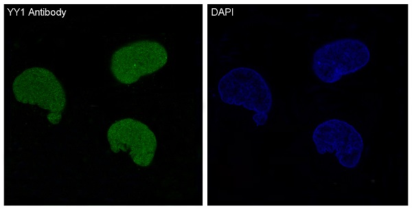 Immunofluorescent analysis of Hela cells, using YY1 Antibody.