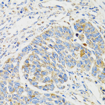 Immunohistochemistry - SH2B1 Polyclonal Antibody 
