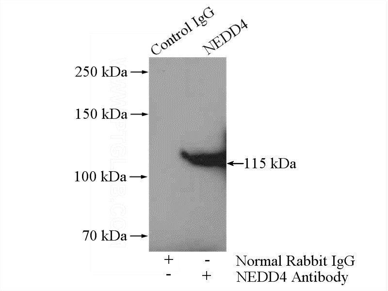 IP Result of anti-NEDD4 (IP:Catalog No:113096, 4ug; Detection:Catalog No:113096 1:500) with C6 cells lysate 1600ug.