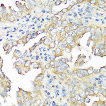 Immunohistochemistry - EIF3B Polyclonal Antibody 