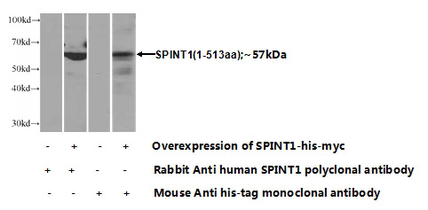 Transfected HEK-293 cells were subjected to SDS PAGE followed by western blot with Catalog No:115574(SPINT1 Antibody) at dilution of 1:1000