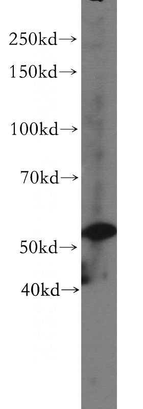 HepG2 cells were subjected to SDS PAGE followed by western blot with Catalog No:116756(C14orf133 antibody) at dilution of 1:300