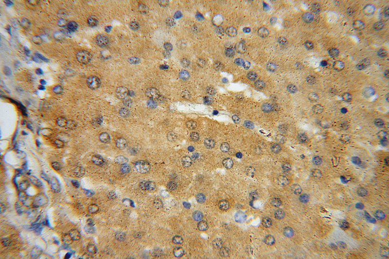 Immunohistochemical of paraffin-embedded human liver using Catalog No:116773(VPS16 antibody) at dilution of 1:100 (under 40x lens)