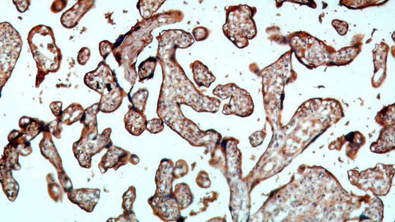 Immunohistochemical of paraffin-embedded human placenta using Catalog No:110627(FGD3 antibody) at dilution of 1:50 (under 10x lens)