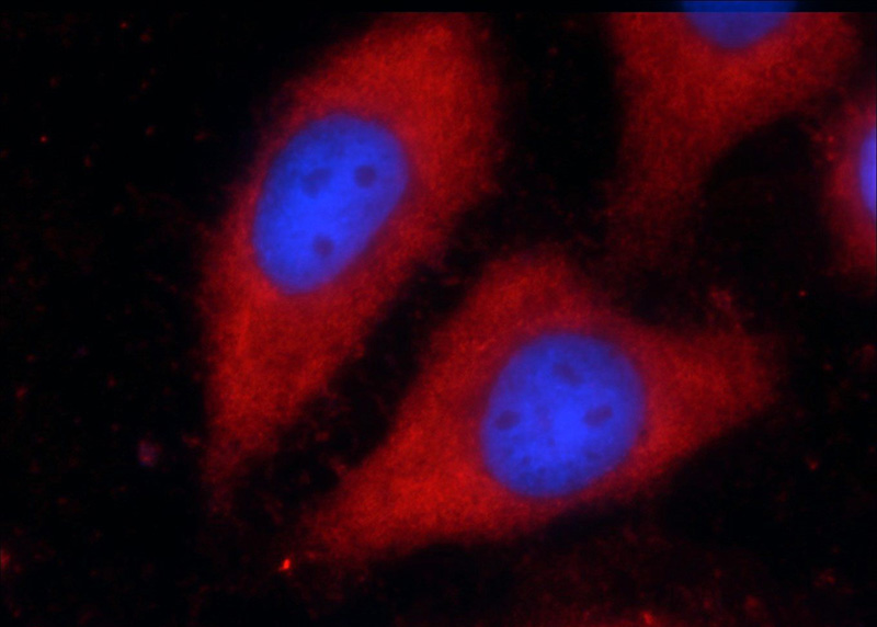 Immunofluorescent analysis of HepG2 cells using Catalog No:116709(VAMP7 Antibody) at dilution of 1:25 and Rhodamine-Goat anti-Rabbit IgG