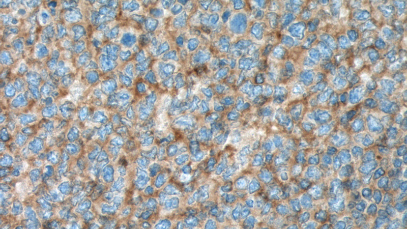 Immunohistochemistry of paraffin-embedded human tonsillitis tissue slide using (CD200 Antibody) at dilution of 1:200 (under 40x lens). heat mediated antigen retrieved with Tris-EDTA buffer(pH9).
