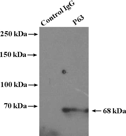 IP Result of anti-TP63 (IP:Catalog No:113558, 4ug; Detection:Catalog No:113558 1:300) with A431 cells lysate 1200ug.