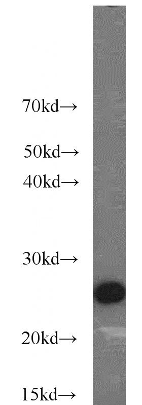 HL-60 cells were subjected to SDS PAGE followed by western blot with Catalog No:108391(BCL2 antibody) at dilution of 1:1000