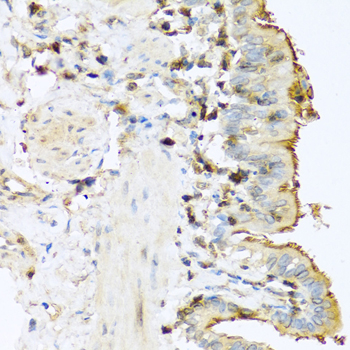 Immunohistochemistry - PRSS1 Polyclonal Antibody 