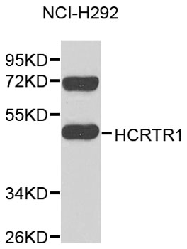 Western blot - HCRTR1 Polyclonal Antibody 