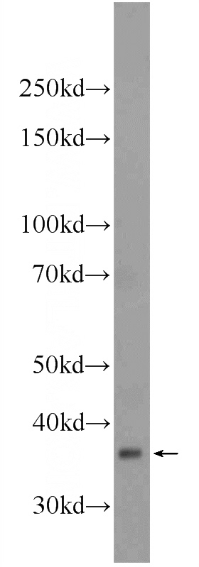 mouse liver tissue were subjected to SDS PAGE followed by western blot with Catalog No:112736(MOSC2 Antibody) at dilution of 1:1000