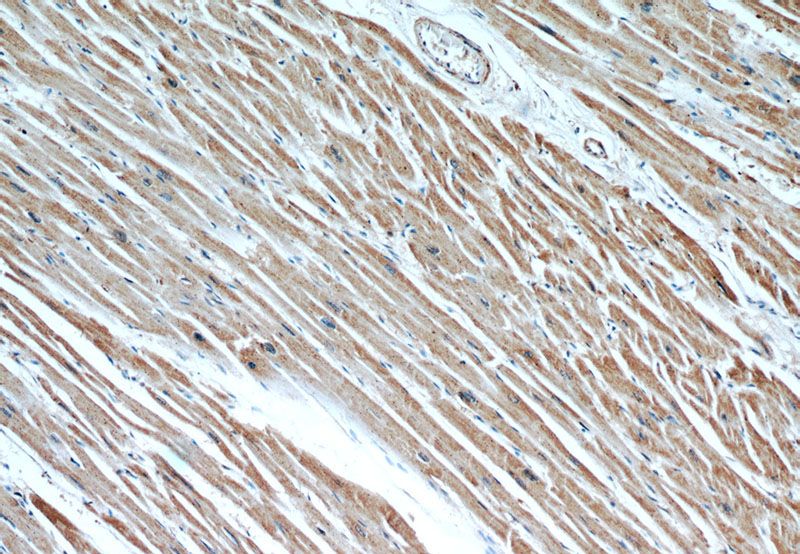 Immunohistochemical of paraffin-embedded human heart using Catalog No:107173(CPT1A antibody) at dilution of 1:50 (under 10x lens)