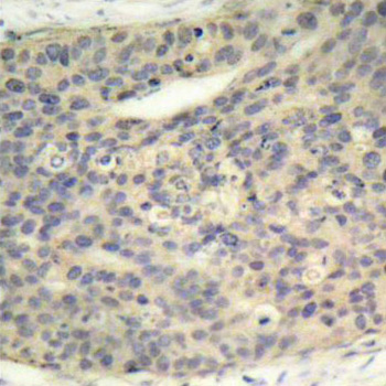 Immunohistochemistry - Phospho-LIMK1-T508 pAb 