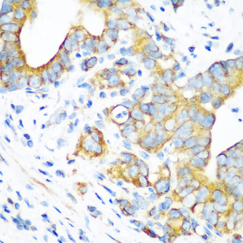 Immunohistochemistry - MTCO2 Polyclonal Antibody 
