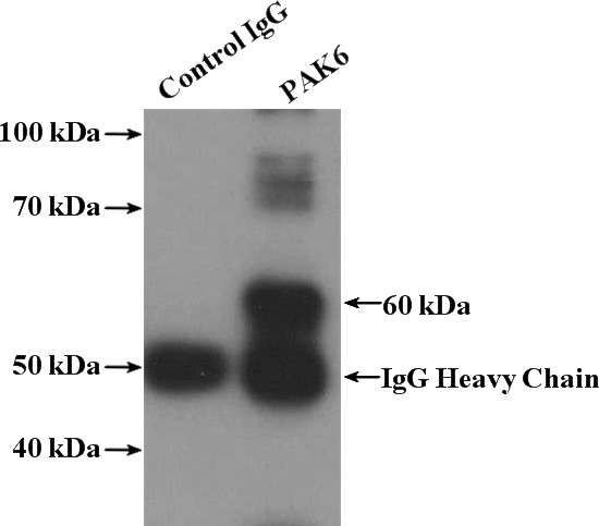 IP Result of anti-PAK6 (IP:Catalog No:113501, 4ug; Detection:Catalog No:113501 1:300) with mouse testis tissue lysate 4000ug.