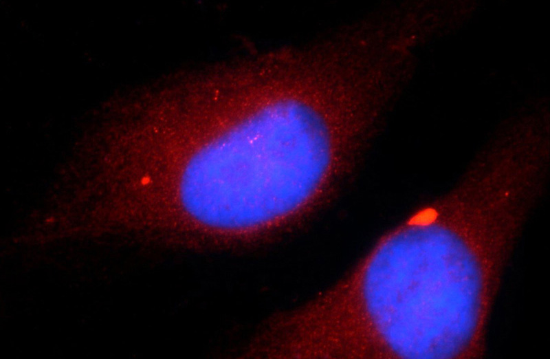 Immunofluorescent analysis of HepG2 cells using Catalog No:117154(ZNF277 Antibody) at dilution of 1:25 and Rhodamine-Goat anti-Rabbit IgG