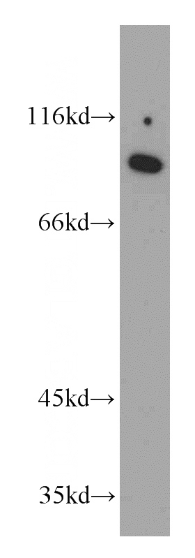 HepG2 cells were subjected to SDS PAGE followed by western blot with Catalog No:114360(PYGL antibody) at dilution of 1:500
