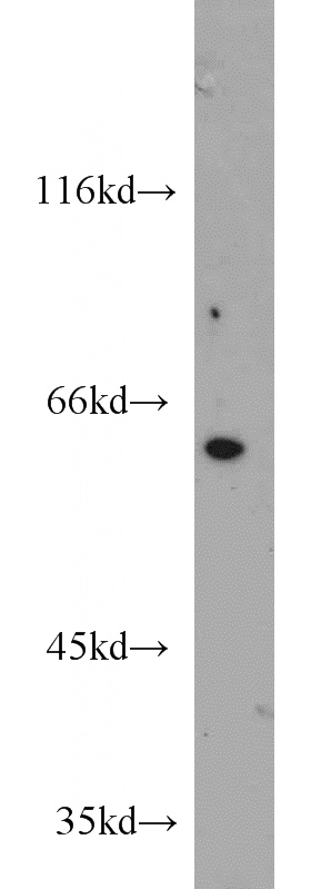 mouse brain tissue were subjected to SDS PAGE followed by western blot with Catalog No:111471(HSBP1 antibody) at dilution of 1:1000