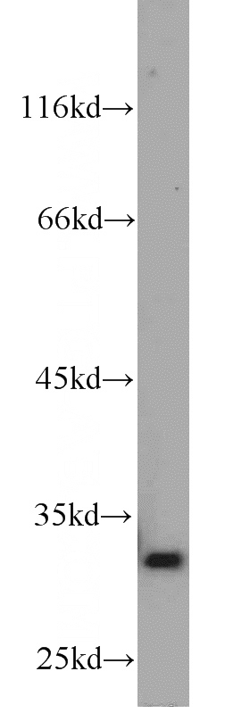 mouse liver tissue were subjected to SDS PAGE followed by western blot with Catalog No:111491(HMOX1 antibody) at dilution of 1:600