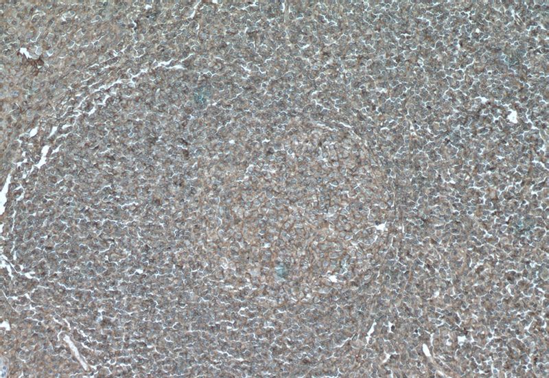 Immunohistochemistry of paraffin-embedded human tonsillitis tissue slide using Catalog No:107263(HLA class I (HLA-A) Antibody) at dilution of 1:200 (under 10x lens)