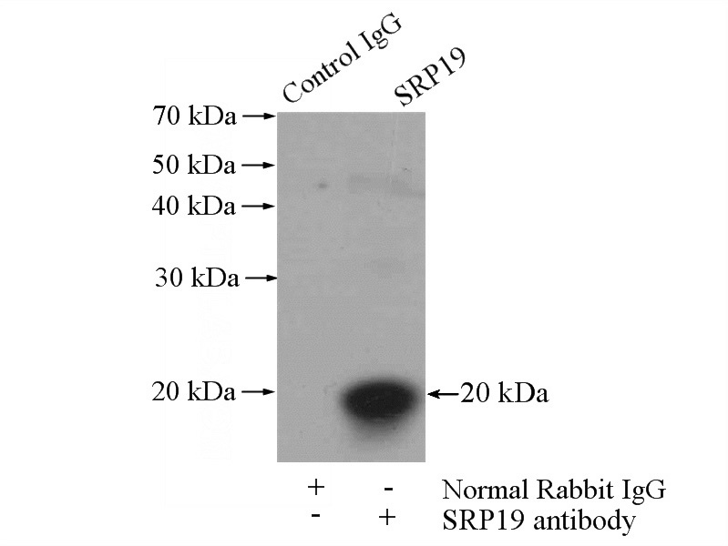 IP Result of anti-SRP19 (IP:Catalog No:115591, 4ug; Detection:Catalog No:115591 1:500) with mouse kidney tissue lysate 4000ug.