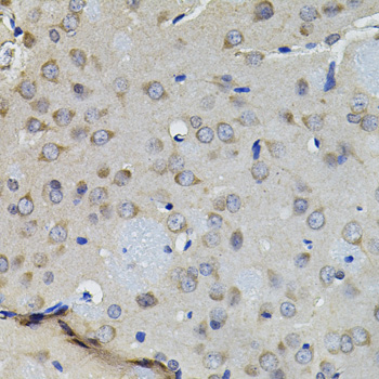 Immunohistochemistry - AURKC Polyclonal Antibody 