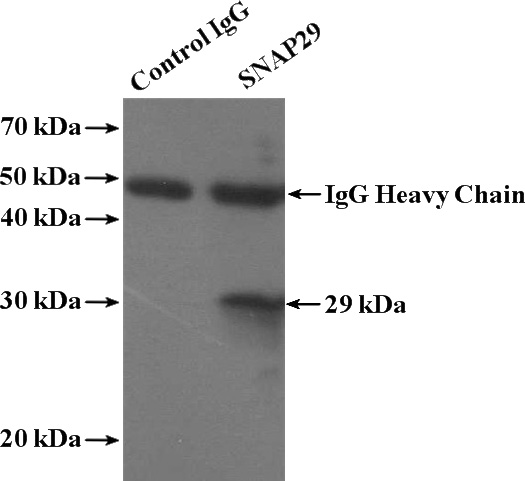 IP Result of anti-SNAP29 (IP:Catalog No:115447, 4ug; Detection:Catalog No:115447 1:600) with Jurkat cells lysate 3200ug.
