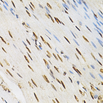 Immunohistochemistry - KPNA4 Polyclonal Antibody 