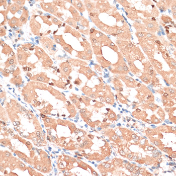 Immunohistochemistry - HMGA1 Polyclonal Antibody 