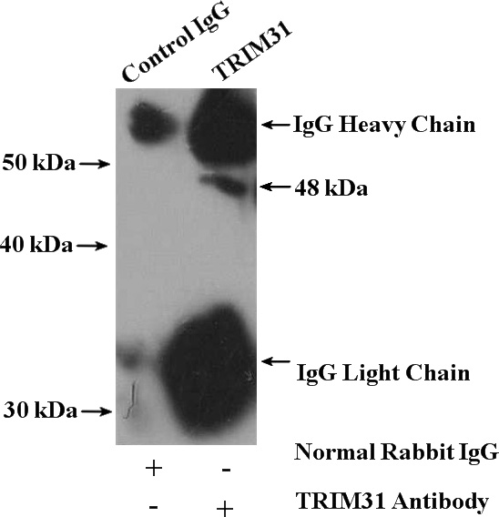 IP Result of anti-TRIM31 (IP:Catalog No:116310, 4ug; Detection:Catalog No:116310 1:400) with COLO 320 cells lysate 3200ug.