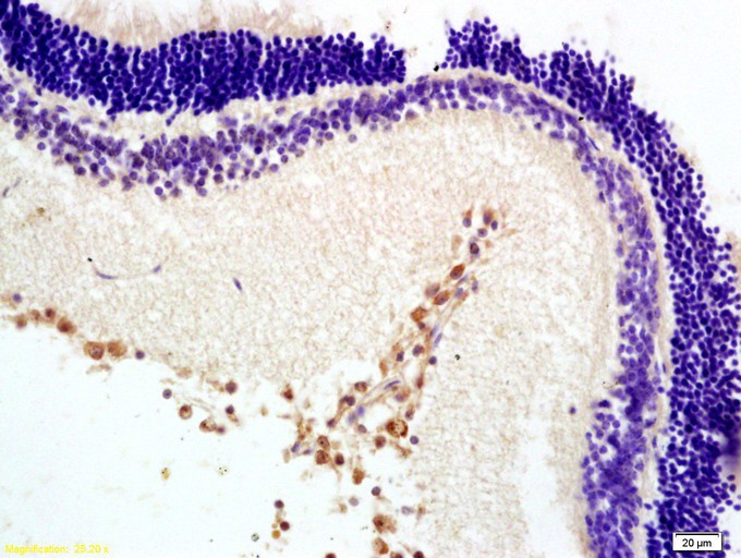 Fig2: Tissue/cell: rat retina tissue; 4% Paraformaldehyde-fixed and paraffin-embedded;; Antigen retrieval: citrate buffer ( 0.01M, pH 6.0 ), Boiling bathing for 15min; Block endogenous peroxidase by 3% Hydrogen peroxide for 30min; Blocking buffer (normal goat serum,C-0005) at 37℃ for 20 min;; Incubation: Anti-MTNR1B Polyclonal Antibody, Unconjugated 1:200, overnight at 4℃, followed by conjugation to the secondary antibody(SP-0023) and DAB(C-0010) staining