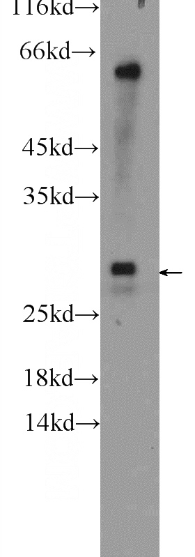 mouse liver tissue were subjected to SDS PAGE followed by western blot with Catalog No:116528(UBE2J2 Antibody) at dilution of 1:300