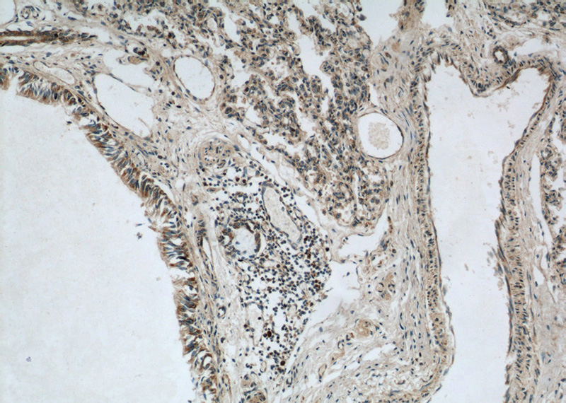 Immunohistochemical of paraffin-embedded human lung using Catalog No:112208(LGI3 antibody) at dilution of 1:50 (under 10x lens)