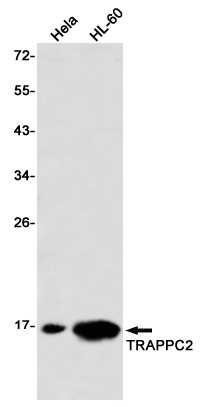 Western blot detection of TRAPPC2 in Hela,HL-60 using TRAPPC2 Rabbit mAb(1:1000 diluted)