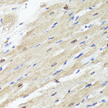 Immunohistochemistry - ACSS2 Polyclonal Antibody 