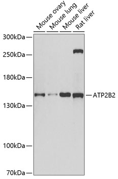 Western blot - ATP2B2 Polyclonal Antibody 