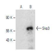 Fig1: Western blot analysis of Ska3 expression in non-transfected (A) and human Ska3 transfected (B) 293T whole cell lysates.