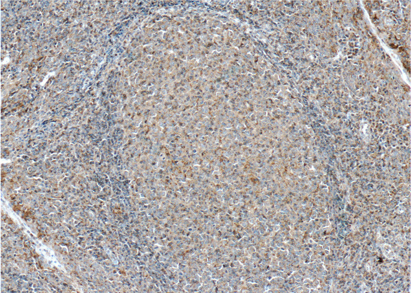 Immunohistochemistry of paraffin-embedded human tonsillitis tissue slide using (PD-L1/CD274 Antibody) at dilution of 1:500 (under 10x lens). heat mediated antigen retrieved with Tris-EDTA buffer(pH9).