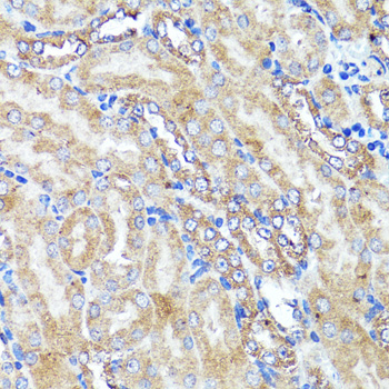 Immunohistochemistry - CNR1 Polyclonal Antibody 