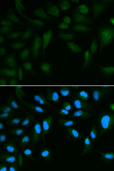 Immunofluorescence - EPPIN Polyclonal Antibody 
