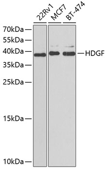 Western blot - HDGF Polyclonal Antibody 