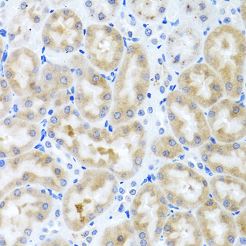 Immunohistochemistry - INHBC Polyclonal Antibody 