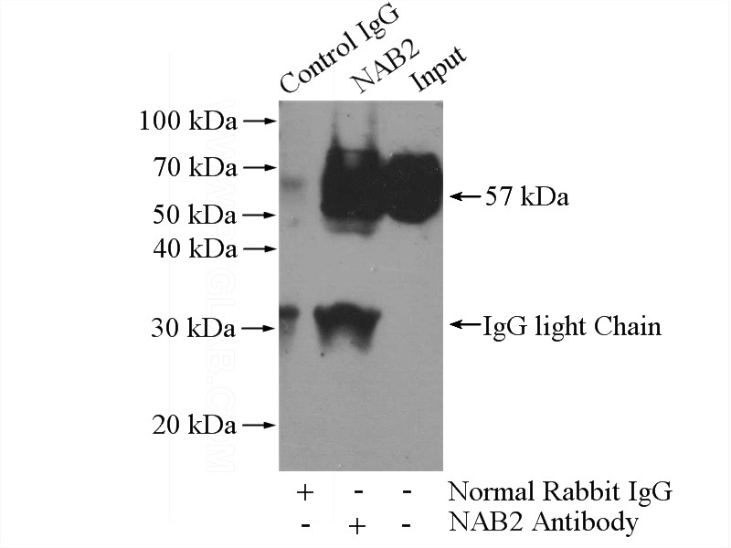 IP Result of anti-NAB2 (IP:Catalog No:113012, 4ug; Detection:Catalog No:113012 1:700) with K-562 cells lysate 3200ug.