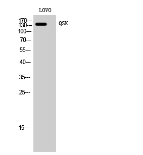 Fig1:; Western Blot analysis of LOVO cells using QSK Polyclonal Antibody