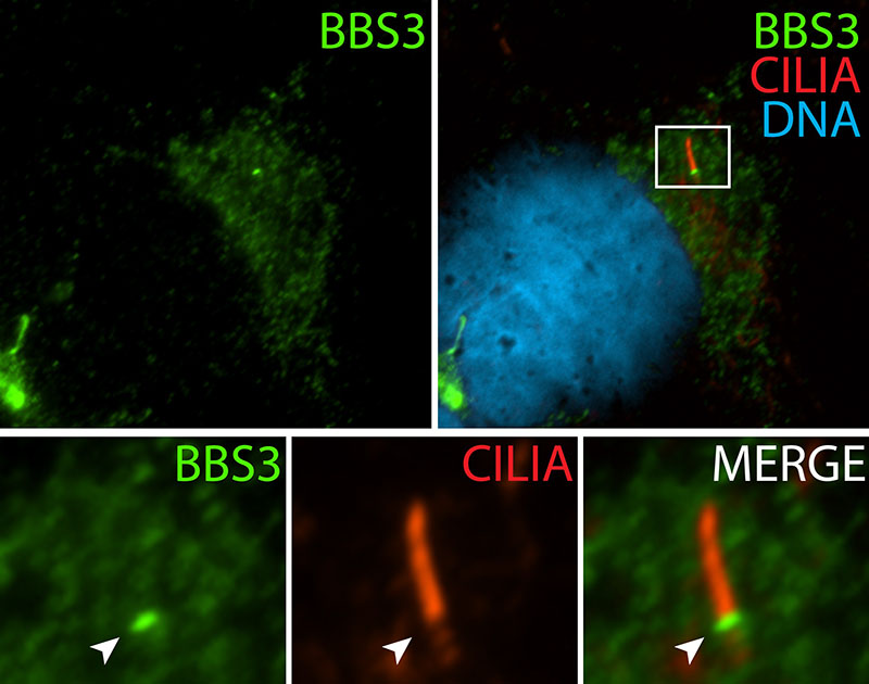 IF result (cytoplasm and the base of cilia stain) of anti-BBS3 (Catalog No:108370; 1:50) with hTERT-RPE1 cell (MeOH fixed) by Dr. Moshe Kim.
