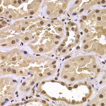 Immunohistochemistry - CSRP2BP Polyclonal Antibody 