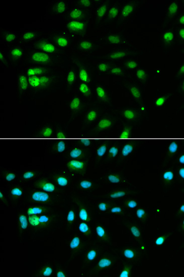 Immunofluorescence - PAX3 Polyclonal Antibody 