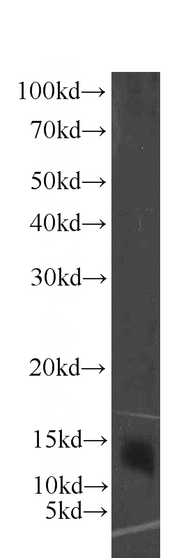 mouse liver tissue were subjected to SDS PAGE followed by western blot with Catalog No:109714(CSTA antibody) at dilution of 1:300